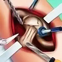 elsa_hip_surgery Spellen